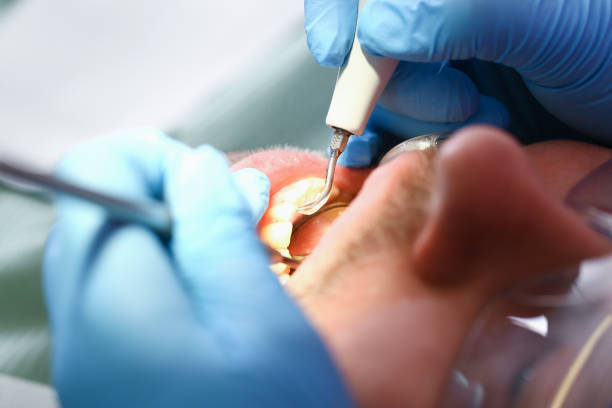 Best Pediatric Emergency Dentist in Cricket, NC