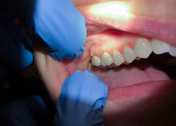 Best Urgent Care for Lost Fillings or Crowns in Cricket, NC